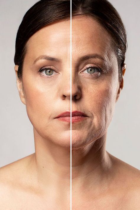 botox treatment in paschim vihar